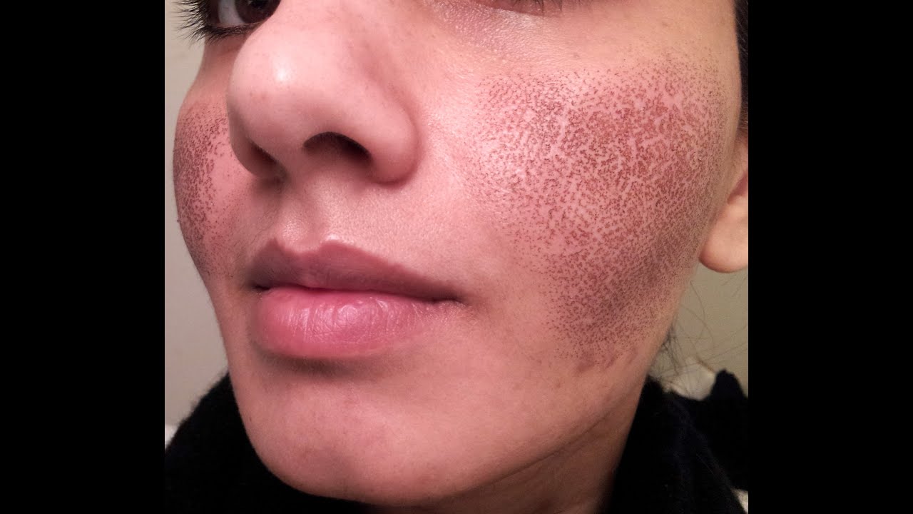 skin doctors no more pores review